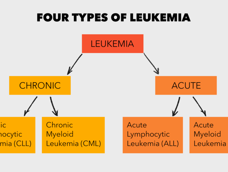 Types Of Leukemia — Symptoms Causes And Treatment Healthy Time Mag